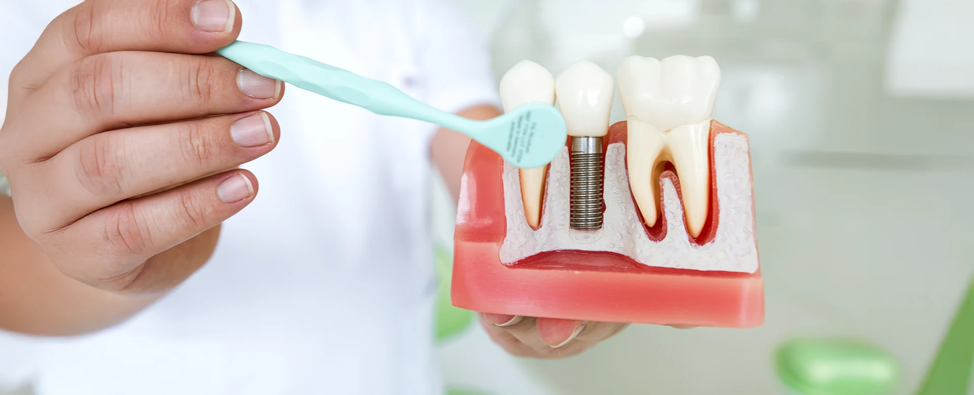 Dentist holding a model of a dental implant next to natural teeth